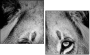 39012933