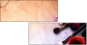 145026645