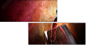 28158439