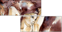 41178185