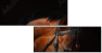 46187059