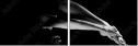 35216204