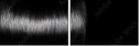 62623049