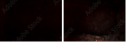 69305872