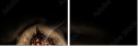 74493123