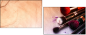 145026645