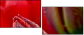 15487800