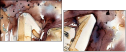 41178185