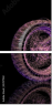 22171142