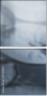 27192905
