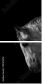 55501476