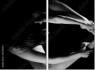 35216204