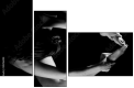 35216204