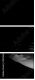 35216204