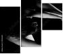 35216204