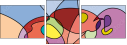 113411334