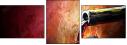 28158439