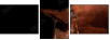 38086864