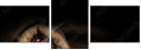 74493123