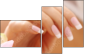 12285447