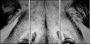 39012933