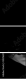 35216204