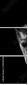 55501476