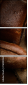 76000562