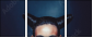 62890814