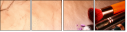 145026645