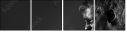 26417303