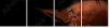 38086864