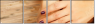 56838122