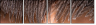 59175977