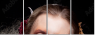68860833