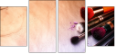 145026645