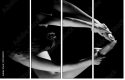35216204
